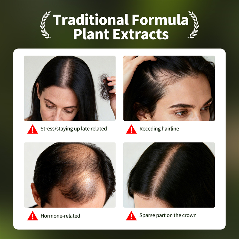 Natural Hair Growth Set Usman  - đánh giá và giá Ingrown Hair Serum