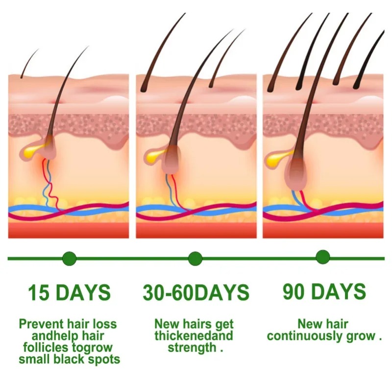 Hair Growth Serum Fast Growing - đánh giá và giá Ingrown Hair Serum