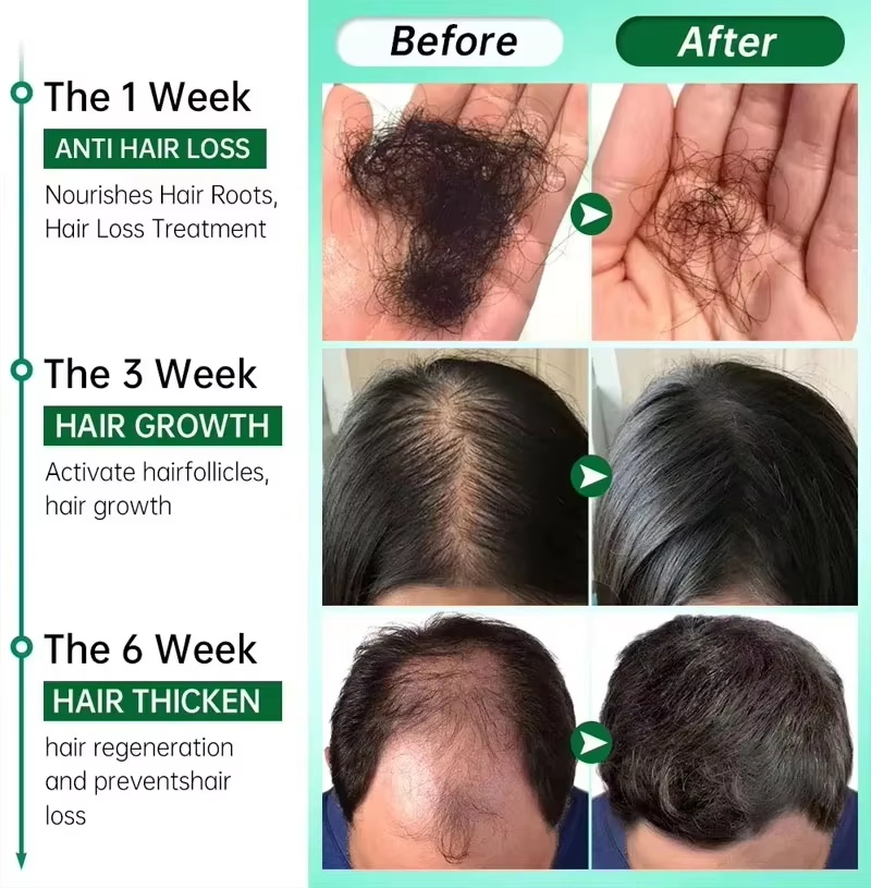 Hair Growth Serum 7 Days Fast  - đánh giá và giá Ingrown Hair Serum