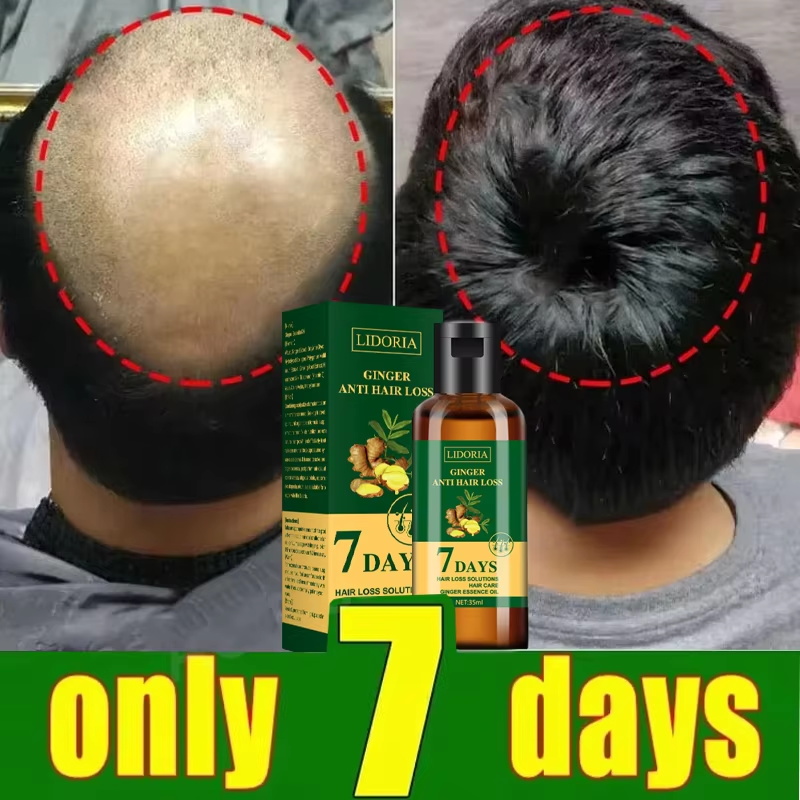 Hair Growth Serum 7 Days Fast  - đánh giá và giá Ingrown Hair Serum