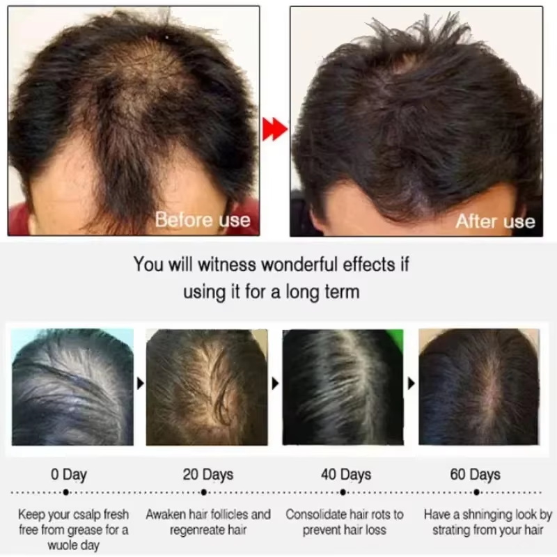 Hair Growth Serum 7 Days Fast  - đánh giá và giá Ingrown Hair Serum