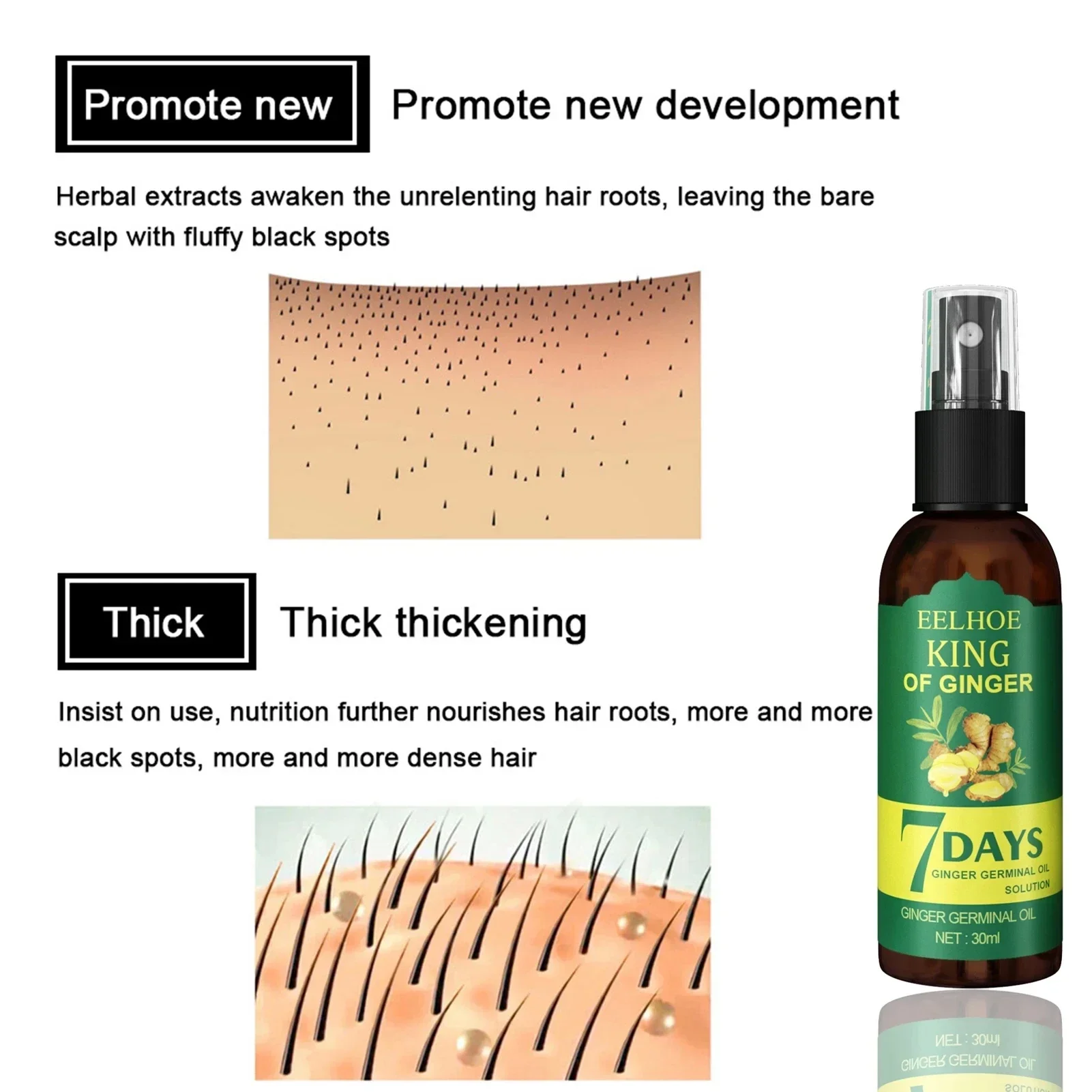 2024 Ginger Hair Growth Serum  - đánh giá và giá Ingrown Hair Serum